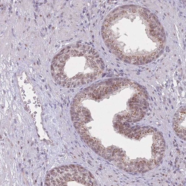 ZC3H14 Antibody in Immunohistochemistry (IHC)