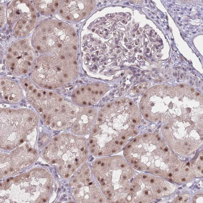 ZC3H14 Antibody in Immunohistochemistry (IHC)