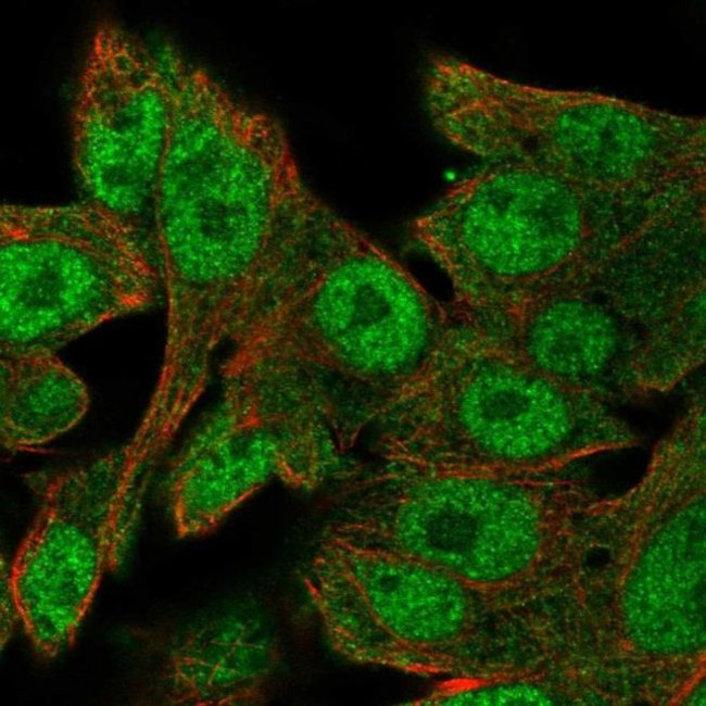 SALL1 Antibody in Immunocytochemistry (ICC/IF)