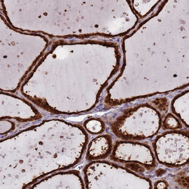 SALL1 Antibody in Immunohistochemistry (IHC)