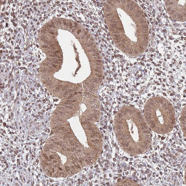 SALL1 Antibody in Immunohistochemistry (IHC)