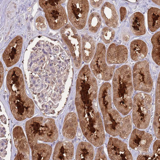 SALL1 Antibody in Immunohistochemistry (IHC)