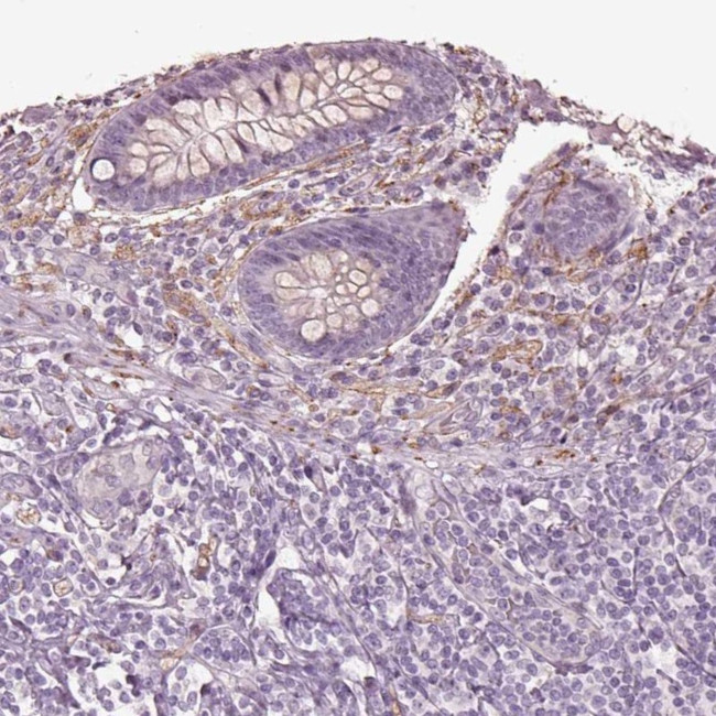 GAL Antibody in Immunohistochemistry (IHC)