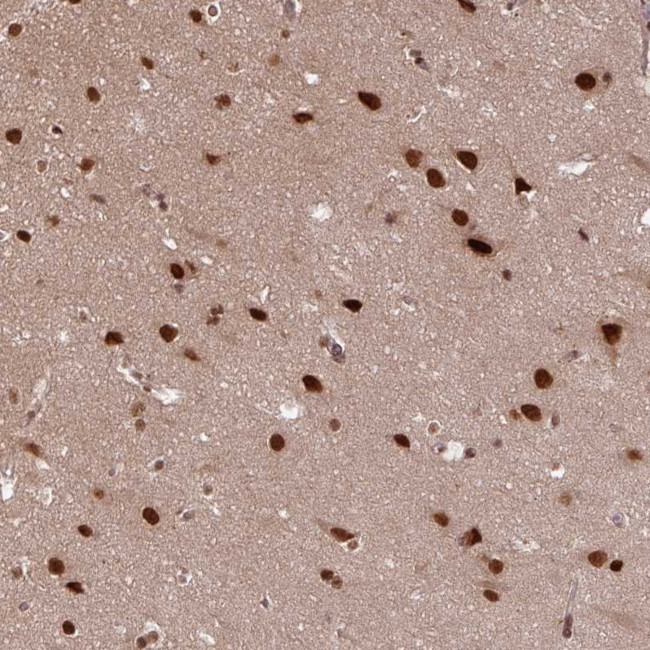 SRSF2 Antibody in Immunohistochemistry (IHC)