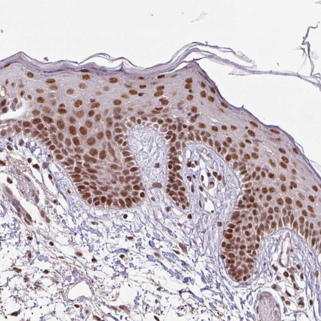 SRSF2 Antibody in Immunohistochemistry (IHC)