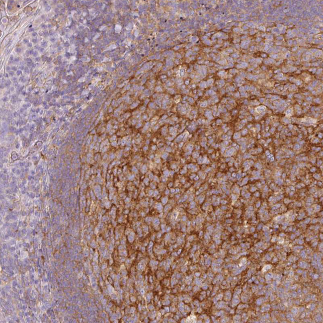 EHD3 Antibody in Immunohistochemistry (IHC)