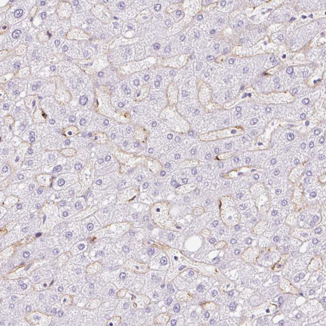 EHD3 Antibody in Immunohistochemistry (IHC)