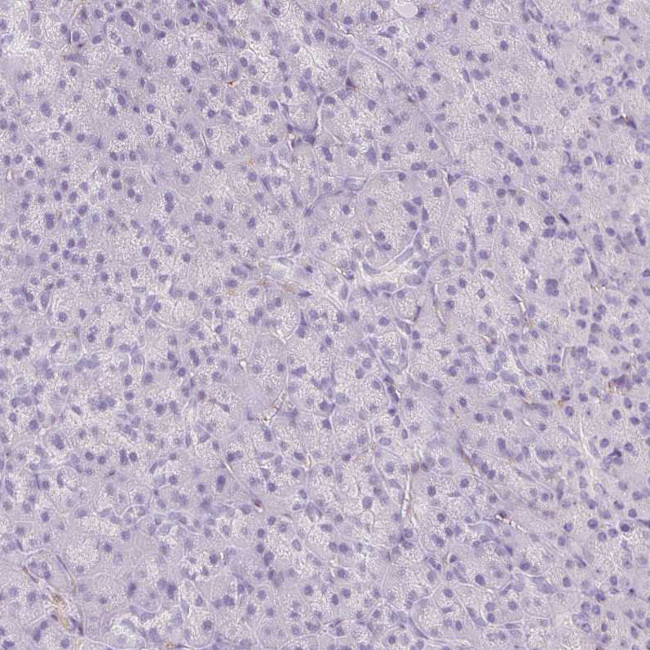 EHD3 Antibody in Immunohistochemistry (IHC)