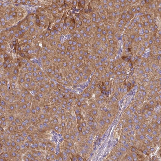 MRRF Antibody in Immunohistochemistry (IHC)