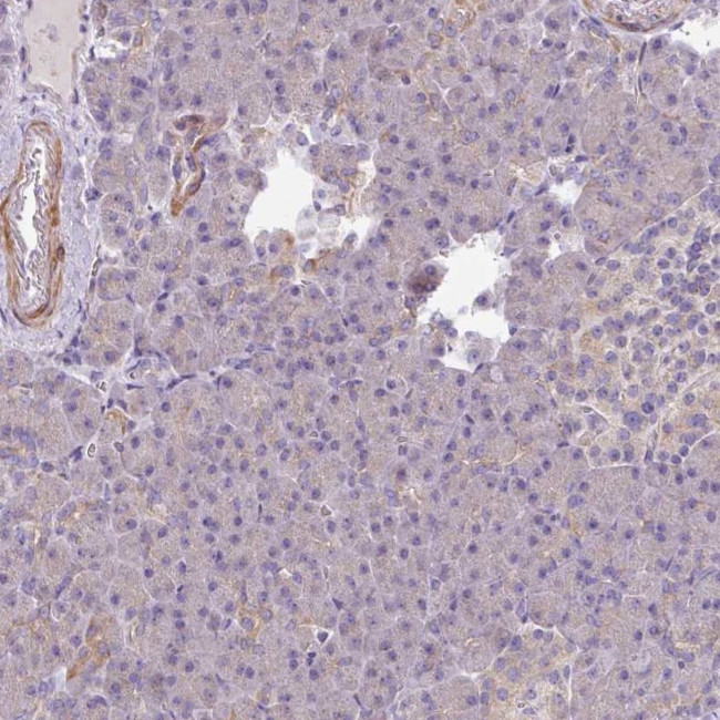 MRRF Antibody in Immunohistochemistry (IHC)