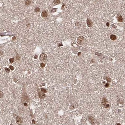 GLYR1 Antibody in Immunohistochemistry (IHC)