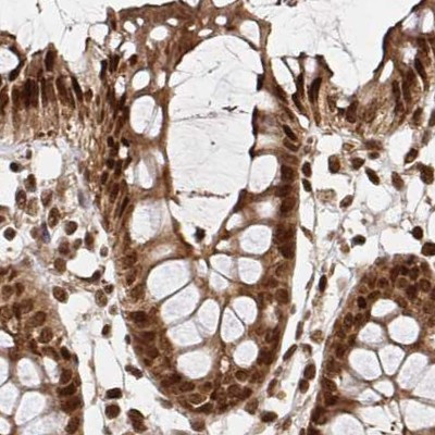 GLYR1 Antibody in Immunohistochemistry (IHC)