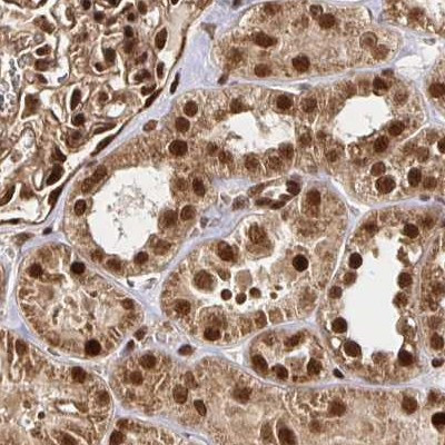 GLYR1 Antibody in Immunohistochemistry (IHC)