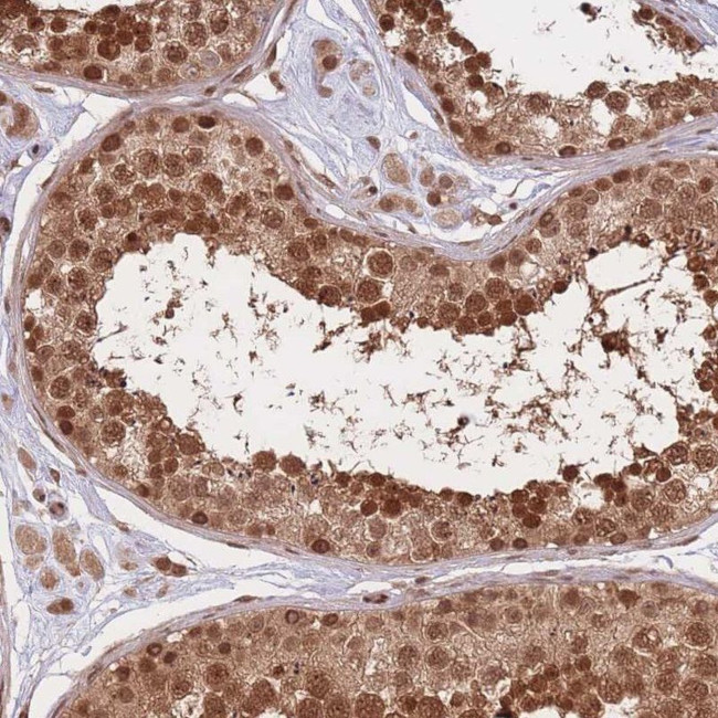 SRA1 Antibody in Immunohistochemistry (IHC)