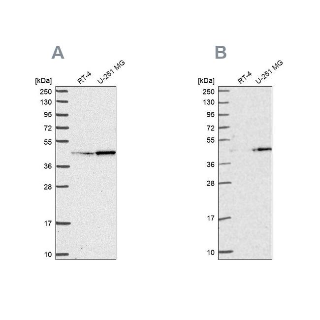 WDR18 Antibody in Western Blot (WB)