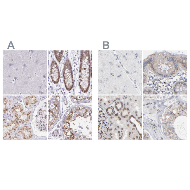 Nesprin 2 Antibody in Immunohistochemistry (IHC)