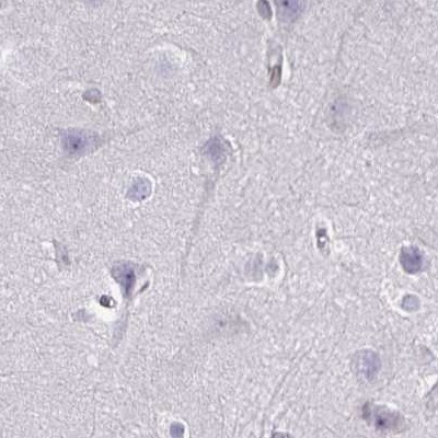 Nesprin 2 Antibody in Immunohistochemistry (IHC)