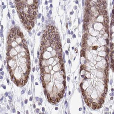 Nesprin 2 Antibody in Immunohistochemistry (IHC)