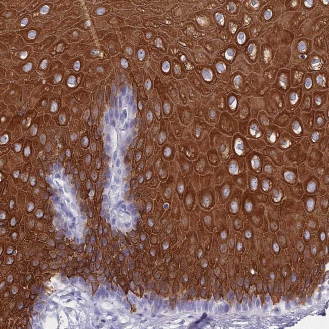 RAB2B Antibody in Immunohistochemistry (IHC)