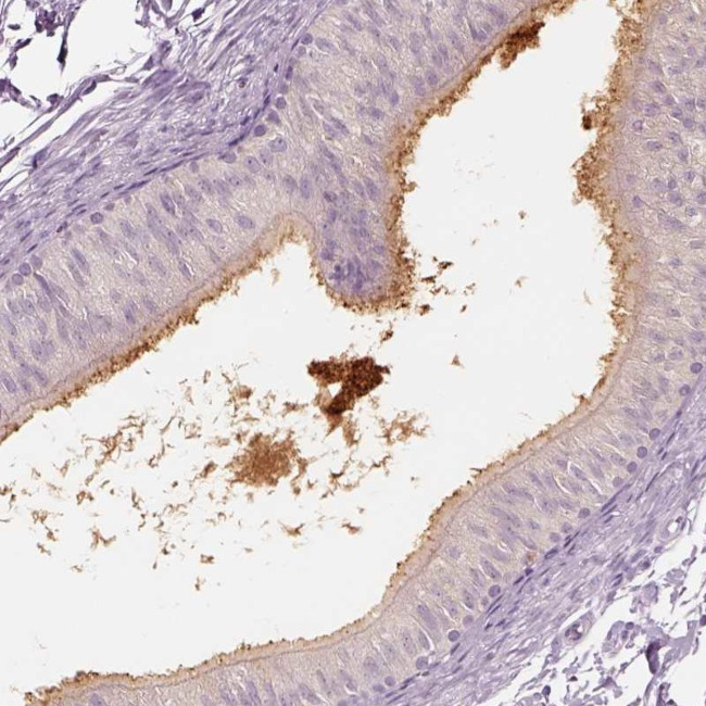 ELSPBP1 Antibody in Immunohistochemistry (IHC)