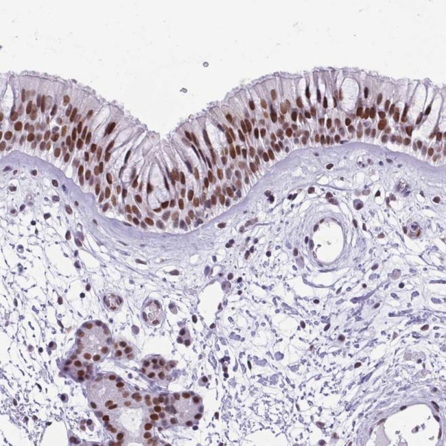 TBC1D26 Antibody in Immunohistochemistry (IHC)