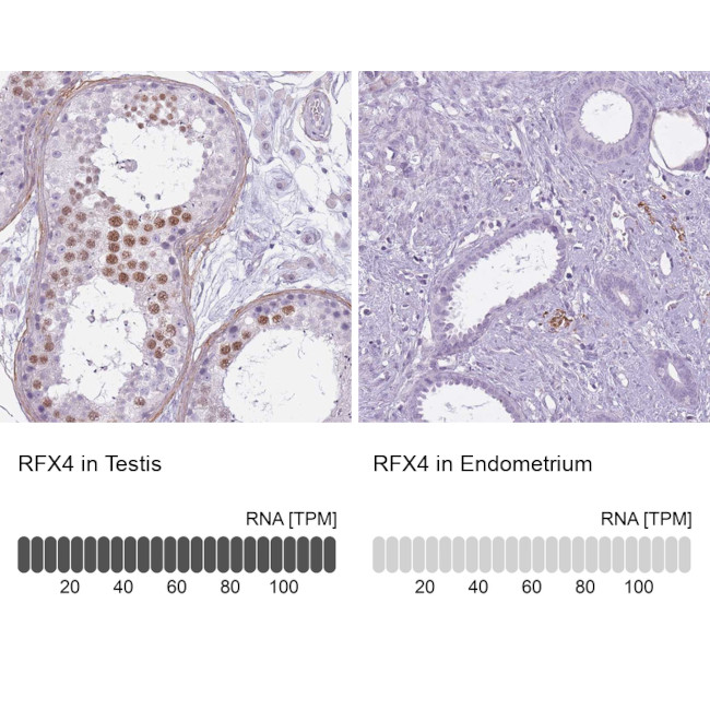 RFX4 Antibody in Immunohistochemistry (IHC)