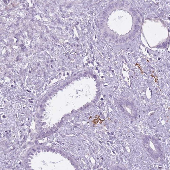 RFX4 Antibody in Immunohistochemistry (IHC)