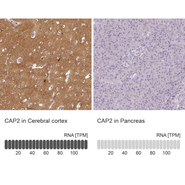 CAP2 Antibody in Immunohistochemistry (IHC)