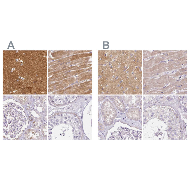 CAP2 Antibody in Immunohistochemistry (IHC)