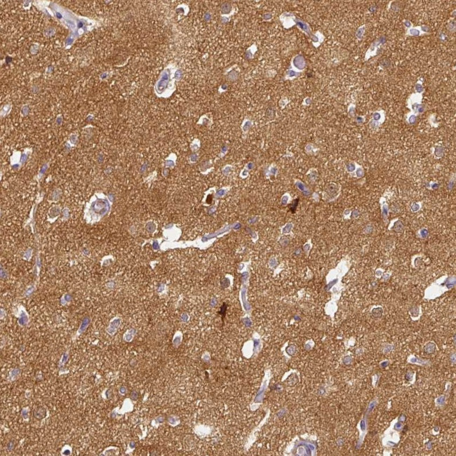 CAP2 Antibody in Immunohistochemistry (IHC)