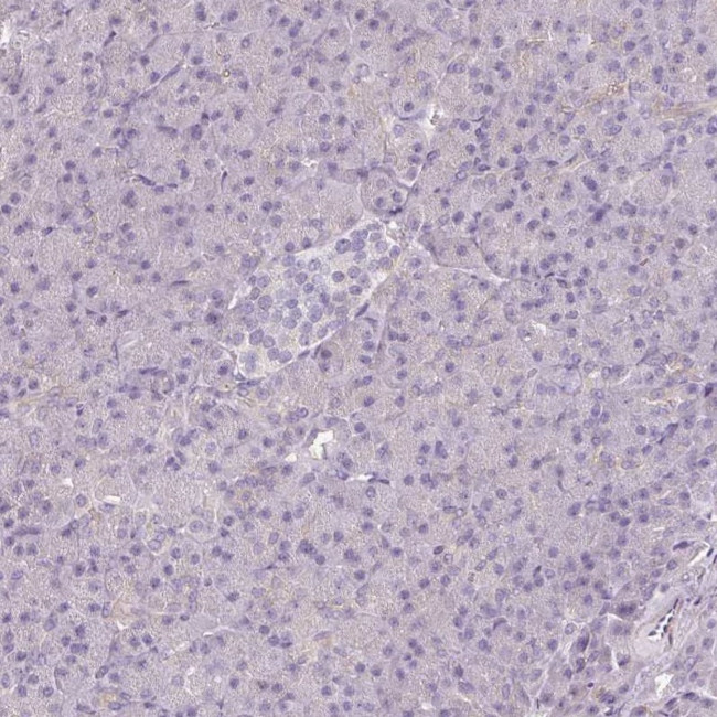 CAP2 Antibody in Immunohistochemistry (IHC)