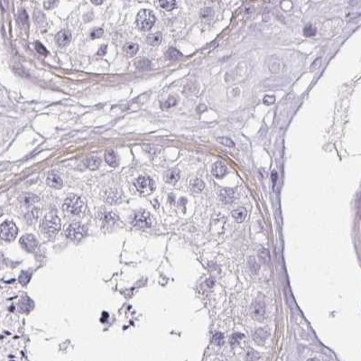 CAP2 Antibody in Immunohistochemistry (IHC)