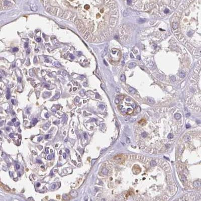 CAP2 Antibody in Immunohistochemistry (IHC)