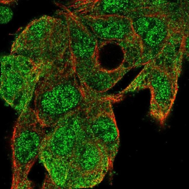 UBE2G1 Antibody in Immunocytochemistry (ICC/IF)