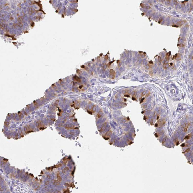 DNAI2 Antibody in Immunohistochemistry (IHC)