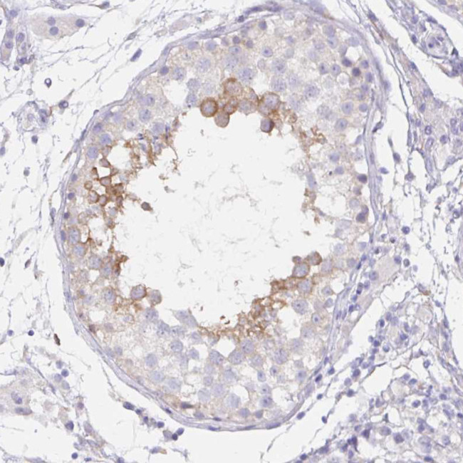 DNAI2 Antibody in Immunohistochemistry (IHC)