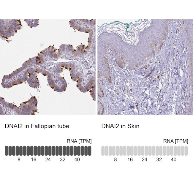 DNAI2 Antibody