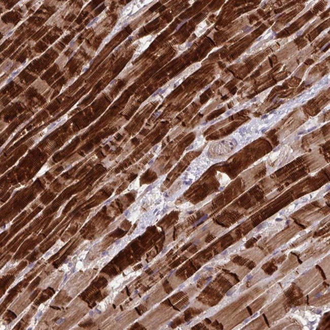 INTS10 Antibody in Immunohistochemistry (IHC)