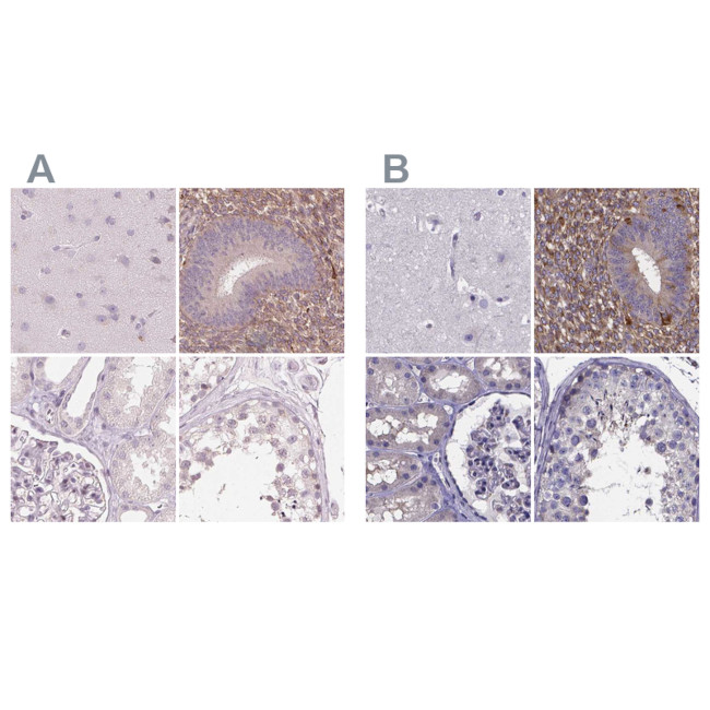 SFRP4 Antibody in Immunohistochemistry (IHC)