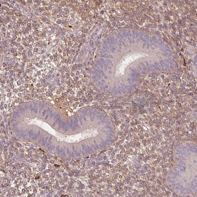 SFRP4 Antibody in Immunohistochemistry (IHC)