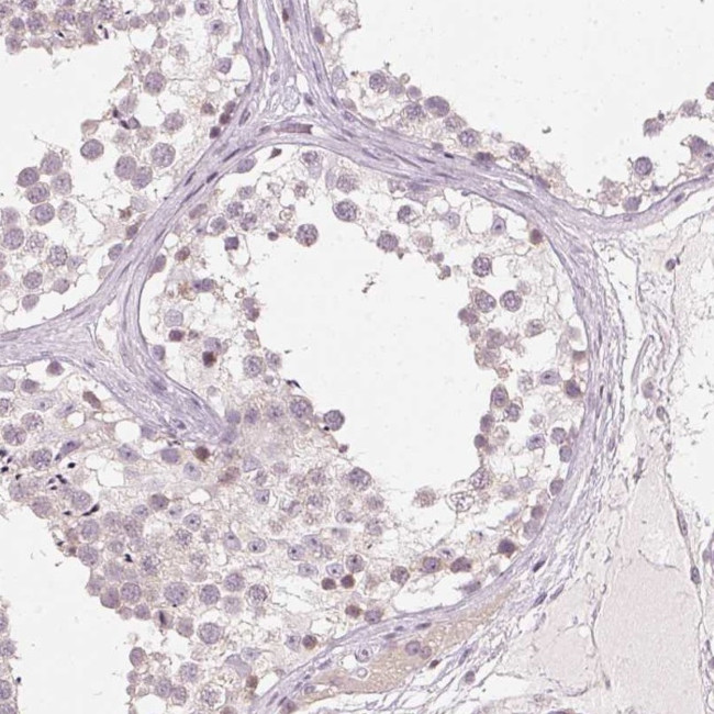 SFRP4 Antibody in Immunohistochemistry (IHC)