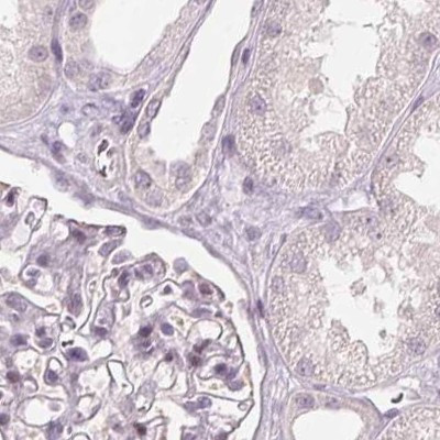 SFRP4 Antibody in Immunohistochemistry (IHC)