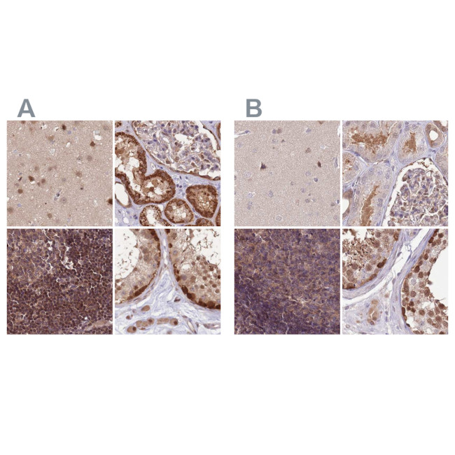 NSFL1C Antibody in Immunohistochemistry (IHC)