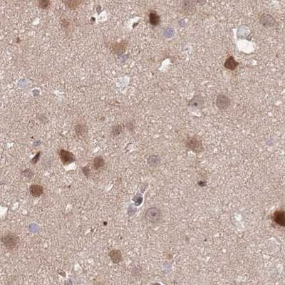 NSFL1C Antibody in Immunohistochemistry (IHC)