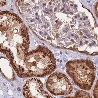 NSFL1C Antibody in Immunohistochemistry (IHC)