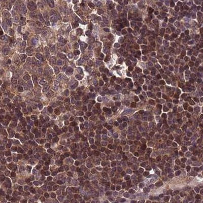 NSFL1C Antibody in Immunohistochemistry (IHC)