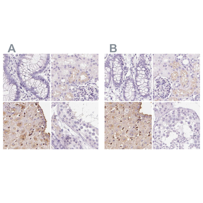 IGFBP-1 Antibody in Immunohistochemistry (IHC)