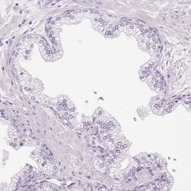 IGFBP-1 Antibody in Immunohistochemistry (IHC)