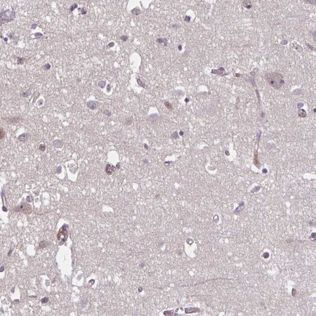 HMBS Antibody in Immunohistochemistry (IHC)