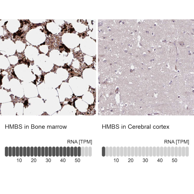 HMBS Antibody